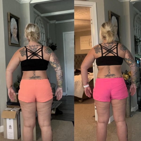 before and after back view